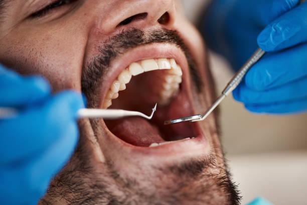Best Broken Tooth Emergency  in Delhi, CA