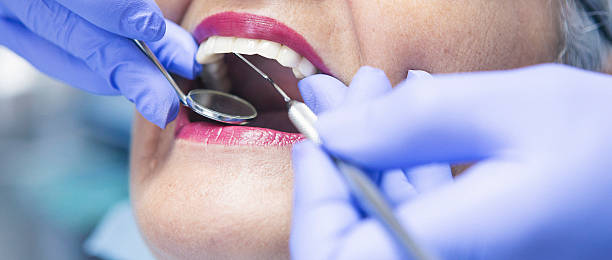 Emergency Gum Pain Relief in CA